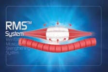RMS system 1